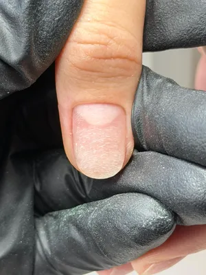 After Russian manicure